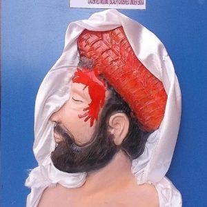 Physilab Lactered Wound Scalp